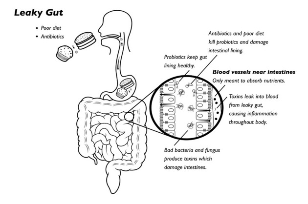 3 suplimente excelente pentru sănătatea intestinală